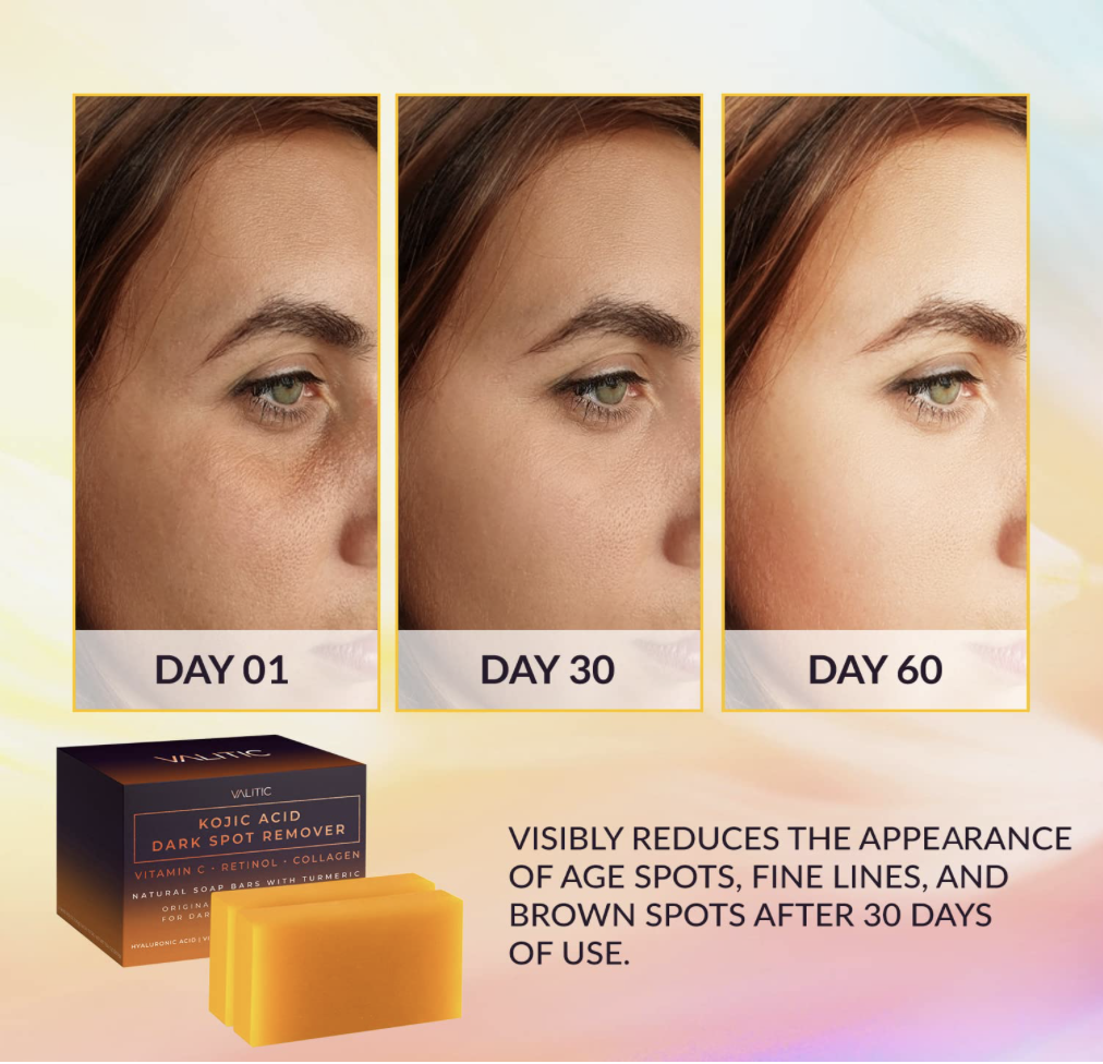 Before and after image showing skin improvement from Day 1 to Day 60 using VALITIC Kojic Acid Dark Spot Remover, highlighting reduction of age spots and fine lines.