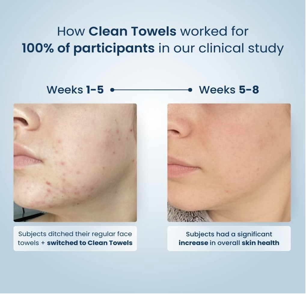 Side-by-side before and after comparison showing improved skin health over 8 weeks of using Clean Towels™, with participants switching from regular towels and reporting noticeable clarity and reduced breakouts.